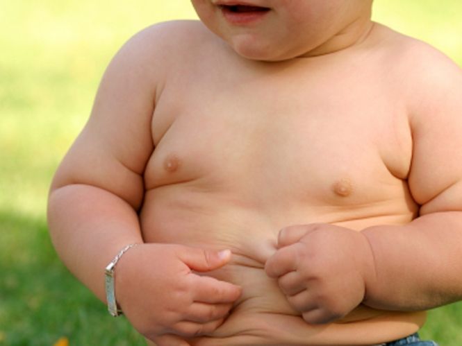 Genetic obesity in children